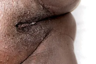 Darkskin With A Fat Ass🍫 , Wet Pussy😜💦 Qv Specials 🥳 24/7 photo 5