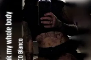 hit me up serious injuries only photo 6